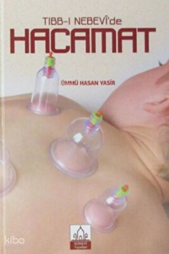 Tıbb-ı Nebevi`de Hacamat